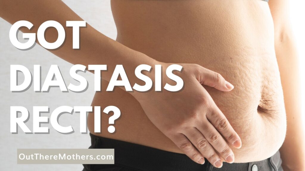 Do You Have Diastasis Recti Here Are Things you Need To Know