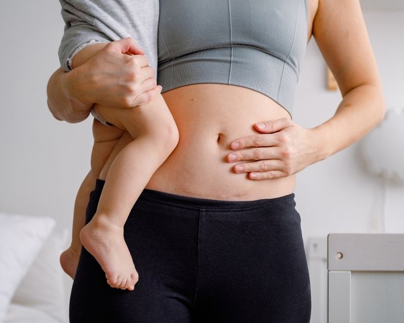 these 5 post c section core exercises bring many benefits to new moms