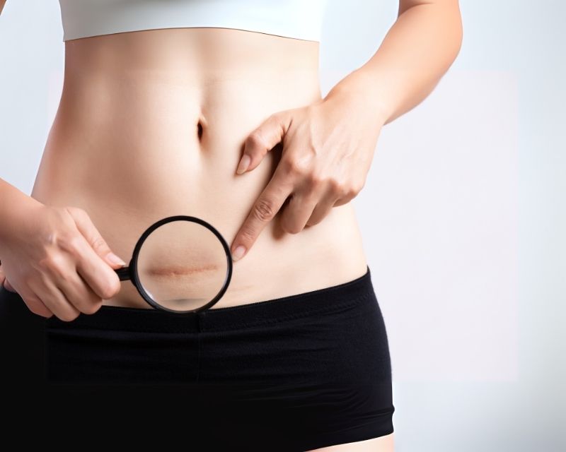 do these post c section core exercises only within your comfort level